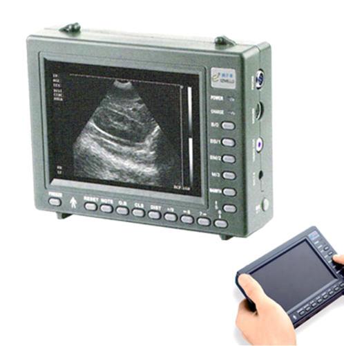 Ультразвуковой сканер PalmTop WED-2000